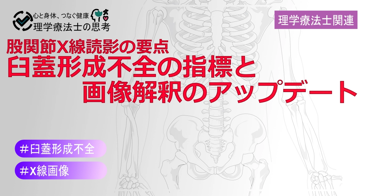 【2024年版】股関節X線読影の要点：臼蓋形成不全の指標と画像解釈のアップデート